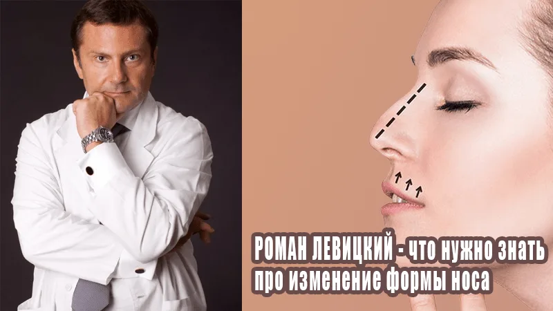Роман Левицкий – пластический хирург о том, что нужно знать про изменение формы носа (ринопластику) – From-UA: Новини України