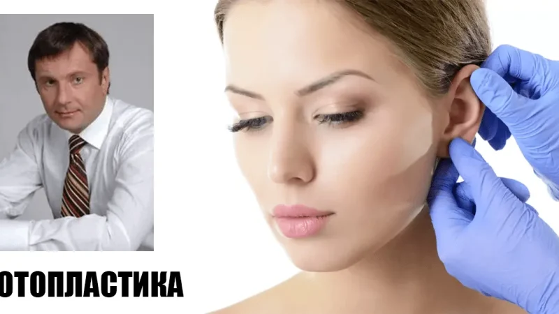 Левицький Роман Миронович. Пластический хирург про отопластику – From-UA: Новини України