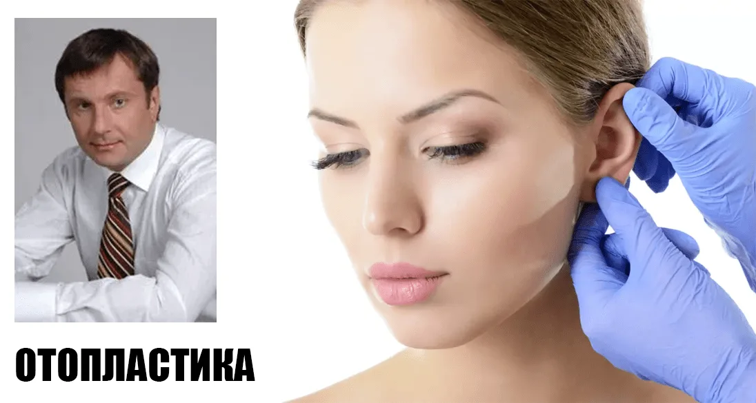 Левицький Роман Миронович. Пластический хирург про отопластику