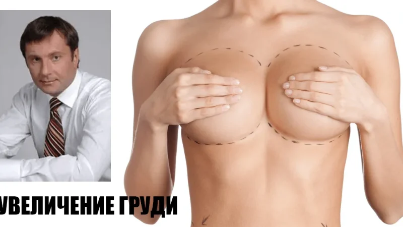 Левицький Роман Миронович. Пластичний хірург. Що потрібно знати про збільшення грудей? – From-UA: Новини України