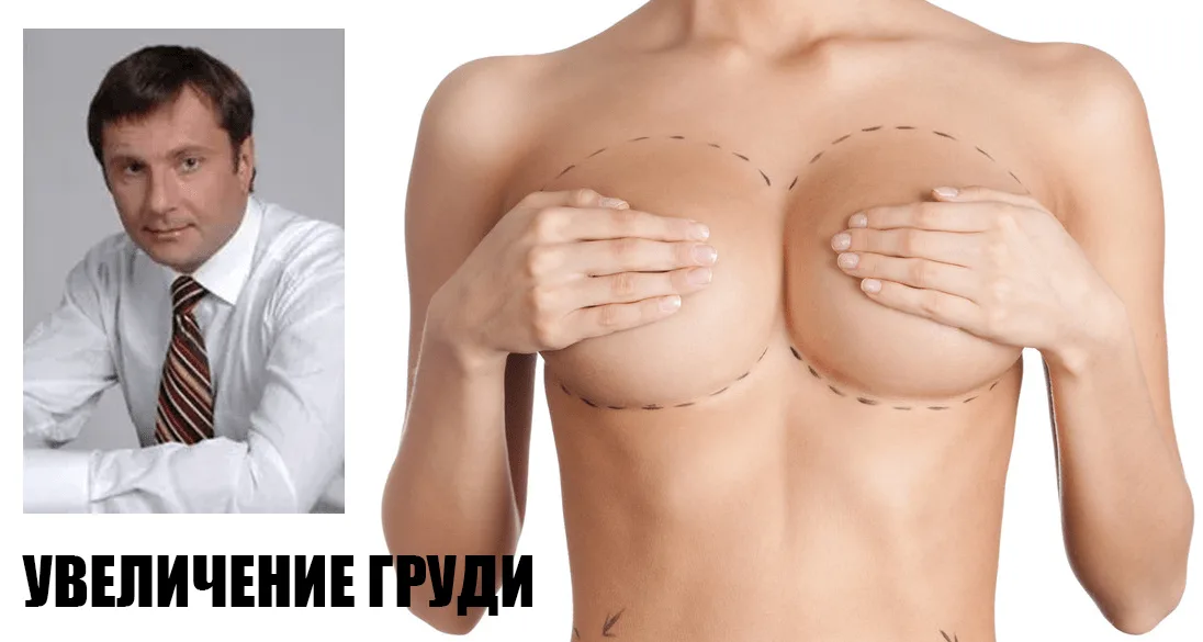Левицький Роман Миронович. Пластичний хірург. Що потрібно знати про збільшення грудей?