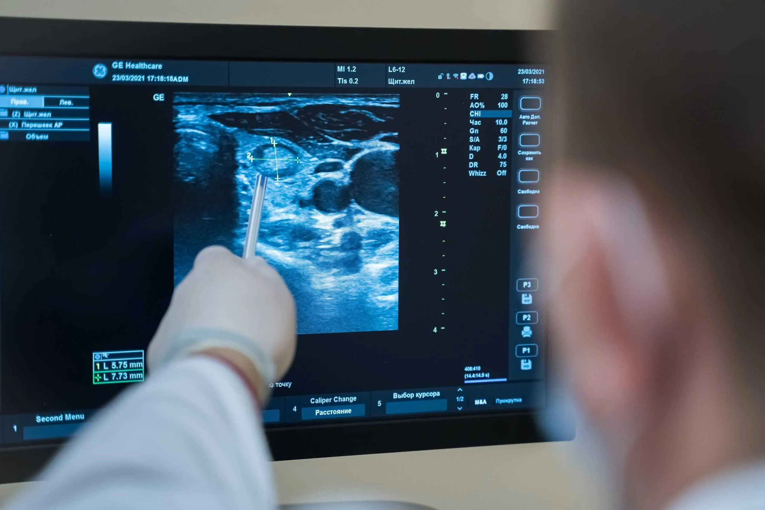 Ви рішили зробити УЗД. Тоді фахівці з «Urologist Valetskyi» познайомлять Вас з основними різновидами ультразвукової діагностики