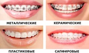 64ff020679c59.webp
