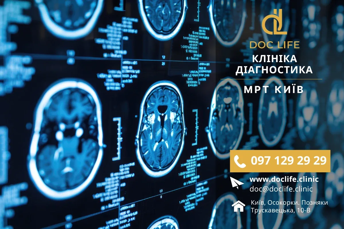 Результати МРТ всього тіла: що ви дізнаєтеся?